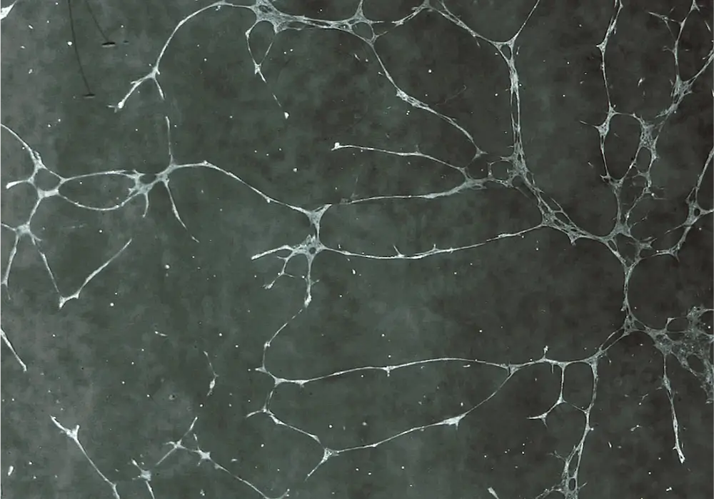 転写後の人工毛細血管（拡大）