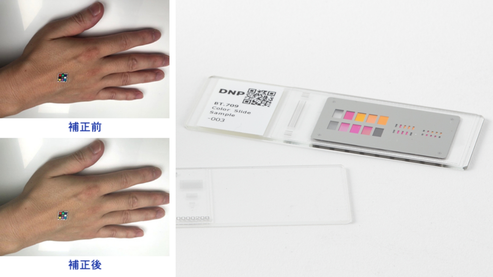 医療用画像のサンプル。診断用に色を補正する前と後の、手の甲の肌の色を比較と色の補正を正確に行うための、医療用のカラーチャート